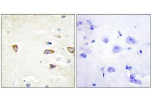 Immunohistochemistry (IHC) image for anti-CDC42 Binding Protein Kinase beta (DMPK-Like) (CDC42BPB) (C-Term) antibody (ABIN1850128) (CDC42BPB anticorps  (C-Term))