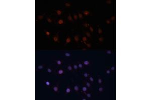 Immunofluorescence analysis of C6 cells using TOM70 antibody (ABIN1683089, ABIN3018839, ABIN3018840 and ABIN6220597) at dilution of 1:100. (TOM70 anticorps  (AA 60-340))