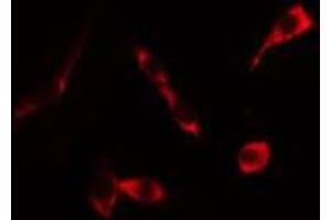 ABIN6276324 staining HeLa cells by IF/ICC. (KRT20 anticorps  (C-Term))