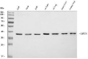 anti-Abhydrolase Domain Containing 4 (ABHD4) (AA 27-342) antibody