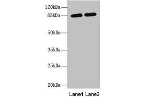 Western blot All lanes: MAGED1 antibody at 5. (MAGED1 anticorps  (AA 579-778))