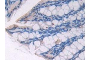 Detection of OPTN in Mouse Small intestine Tissue using Polyclonal Antibody to Optineurin (OPTN)