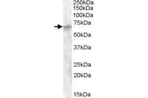 IGF2BP2 polyclonal antibody  (1 ug/mL) staining of HepG2 cell lysate (35 ug protein in RIPA buffer). (IGF2BP2 anticorps)