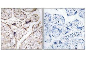Immunohistochemistry (IHC) image for anti-Alkaline Ceramidase 3 (ACER3) (Internal Region) antibody (ABIN1850730) (ACER3 anticorps  (Internal Region))