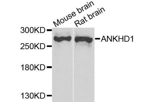 ANKHD1 antibody  (AA 1620-1800)