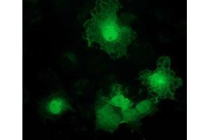 Immunofluorescence (IF) image for anti-Alcohol Dehydrogenase 1B (Class I), beta Polypeptide (ADH1B) antibody (ABIN1496478)