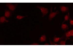 ABIN6269138 staining LOVO by IF/ICC.