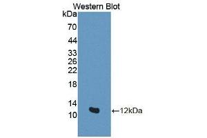 Detection of Recombinant GTF2H5, Human using Polyclonal Antibody to General Transcription Factor IIH, Polypeptide 5 (GTF2H5) (GTF2H5 anticorps  (AA 1-71))