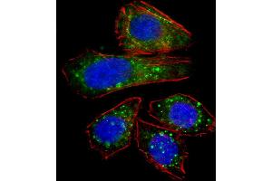 Fluorescent confocal image of U251 cell stained with ZNF81 Antibody (N-term).