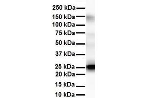WB Suggested Anti-Tmed1 antibody Titration: 1 ug/mL Sample Type: Human liver (TMED1 anticorps  (N-Term))