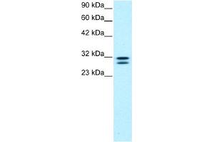 WB Suggested Anti-HTATIP2 Antibody Titration:  0. (HIV-1 Tat Interactive Protein 2, 30kDa (HTATIP2) (N-Term) anticorps)