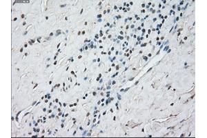 Immunohistochemical staining of paraffin-embedded Kidney tissue using anti-STAT1 mouse monoclonal antibody. (STAT1 anticorps)