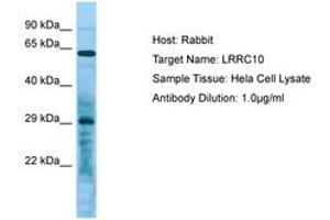 Image no. 1 for anti-Leucine Rich Repeat Containing 10 (LRRC10) (C-Term) antibody (ABIN6750055) (LRRC10 anticorps  (C-Term))