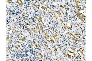 IHC analysis of Filamin B/FLNB using anti-Filamin B/FLNB antibody (ABIN7601606).