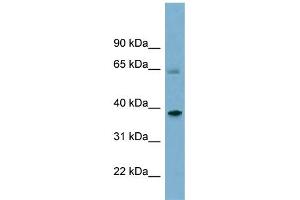 WB Suggested Anti-SNX7 Antibody Titration: 0. (Sorting Nexin 7 anticorps  (Middle Region))