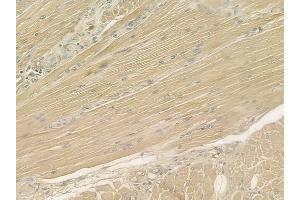 ABIN6260665 and ABIN6277012 at 1/100 staining human tongue carcinoma by IHC-P. (CDA anticorps  (Internal Region))