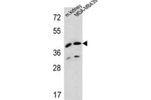 Western Blotting (WB) image for anti-L-2-Hydroxyglutarate Dehydrogenase (L2HGDH) antibody (ABIN2995585) (L2HGDH anticorps)