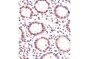 Immunohistochemical analysis of paraffin-embedded H. (MGMT anticorps)
