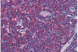 Human Tonsil: Formalin-Fixed, Paraffin-Embedded (FFPE) (Arrestin 3 anticorps  (AA 300-410))