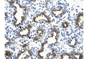 RFP2 antibody was used for immunohistochemistry at a concentration of 4-8 ug/ml to stain Alveolar cells {arrows) in Human Lung. (TRIM13 anticorps  (Middle Region))