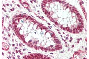 Rabbit Anti-Srrm1 antibody  Formalin Fixed Paraffin Embedded Tissue: Human Colon Primary antibody Concentration: 1:100 Secondary Antibody: Donkey anti-Rabbit-Cy3 Secondary Antibody Concentration: 1:200 Magnification: 20x Exposure Time: 0. (SRRM1 anticorps  (C-Term))