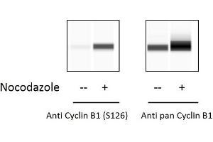 HeLa cells were untreated or treated with Nocodazole for 20 hours. (Cyclin B1 Kit ELISA)
