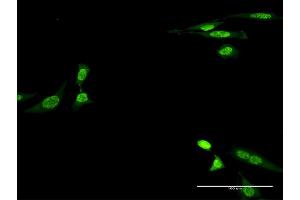 Immunofluorescence of monoclonal antibody to CKM on HeLa cell.