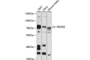 Western blot analysis of extracts of various cell lines, using SEMG2 antibody (ABIN6128756, ABIN6147529, ABIN6147531 and ABIN6216592) at 1:3000 dilution. (SEMG2 anticorps  (AA 383-582))