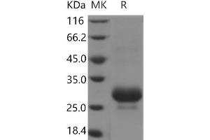 Western Blotting (WB) image for Collagen Triple Helix Repeat Containing 1 (CTHRC1) protein (His tag) (ABIN7321065)