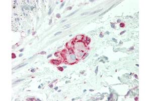 anti-Solute Carrier Family 38 Member 3 (SLC38A3) (AA 31-80) antibody