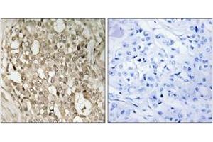 Immunohistochemistry (IHC) image for anti-Nuclear Factor-kB p65 (NFkBP65) (pSer529) antibody (ABIN2888481) (NF-kB p65 anticorps  (pSer529))