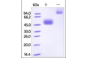 Human NKp30, Fc Tag on SDS-PAGE under reducing (R) and no-reducing (NR) conditions. (NCR3 Protein (AA 19-135) (Fc Tag))