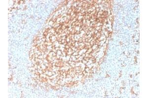 Formalin-fixed, paraffin-embedded human Tonsil stained with CD14-Monospecific Mouse Monoclonal Antibody (LPSR/2385). (CD14 anticorps  (AA 25-148))