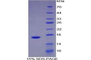 SDS-PAGE analysis of Human ADAMTS4 Protein. (ADAMTS4 Protéine)