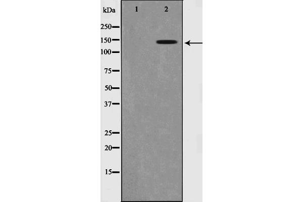 SMC1A antibody  (pSer957)