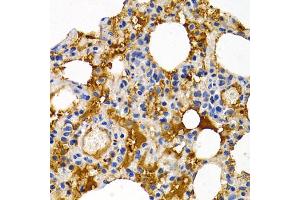 Immunohistochemistry of paraffin-embedded rat lung using TFF1 antibody (ABIN5970904) at dilution of 1/200 (40x lens). (TFF1 anticorps)