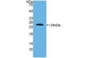 Detection of Recombinant DISC1, Human using Polyclonal Antibody to Disrupted In Schizophrenia 1 (DISC1) (DISC1 anticorps  (AA 102-261))