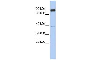 WB Suggested Anti-CCDC157 Antibody Titration: 0. (CCDC157 anticorps  (Middle Region))