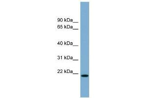 CYBA antibody used at 1 ug/ml to detect target protein. (CYBA anticorps  (Middle Region))