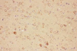 Anti-CNTF Picoband antibody,  IHC(P): Rat Brain Tissue
