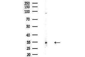 anti-ELOVL Fatty Acid Elongase 1 (ELOVL1) (Internal Region) antibody