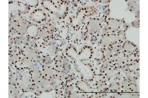 Immunoperoxidase of monoclonal antibody to EP300 on formalin-fixed paraffin-embedded human salivary gland.