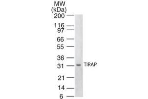 Western blot analysis of TIRAP. (TIRAP anticorps)
