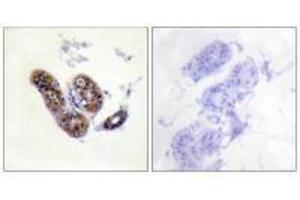 Immunohistochemistry analysis of paraffin-embedded human skin tissue using MITF (Ab-180/73) antibody.
