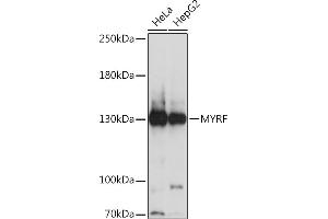 Western blot analysis of extracts of various cell lines, using MYRF Rabbit pAb (ABIN7266372) at 1:1000 dilution. (Chromosome 11open Reading Frame 9 (C11orf9) (AA 1-100) anticorps)