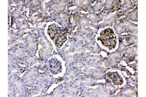 IHC analysis of Laminin using anti-Laminin antibody .