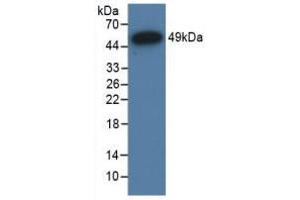 Western Blot; Sample: Recombinant NR3C1, Human. (Glucocorticoid Receptor anticorps  (AA 598-755))