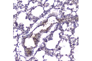 IHC analysis of PDE4D using anti-PDE4D antibody .