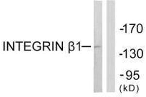 Western blot analysis of extracts from Jurkat cells, using Integrin β1 (Ab-789) antibody. (ITGB1 anticorps  (Thr789))