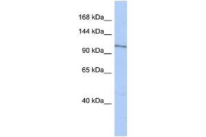 WB Suggested Anti-MAP4K4 Antibody Titration:  0. (MAP4K4 anticorps  (N-Term))